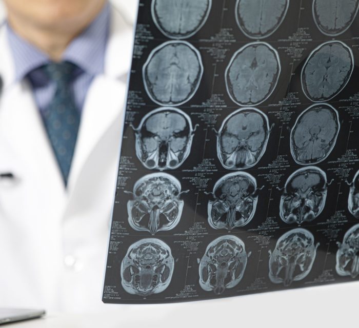 O que é a Neurologia?